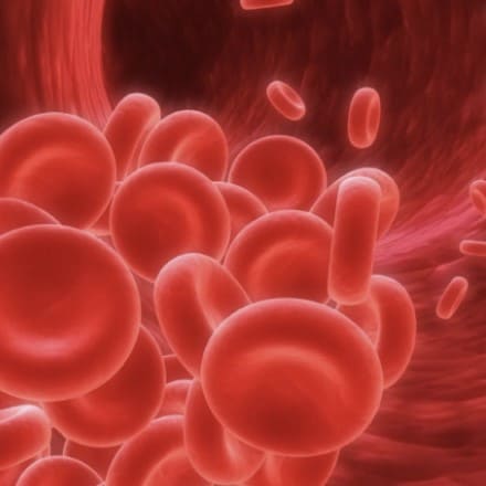 Cuagulacion de sangre - Especialista en várices - Dr. Carlos Acosta Uriegas - Vein Clinic